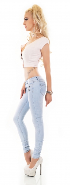 Skinny-Jeans mit süssen Zier-Zippern in light blue