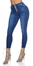 Slim Fit Skinny Jeans mit Knopfleiste - blue washed